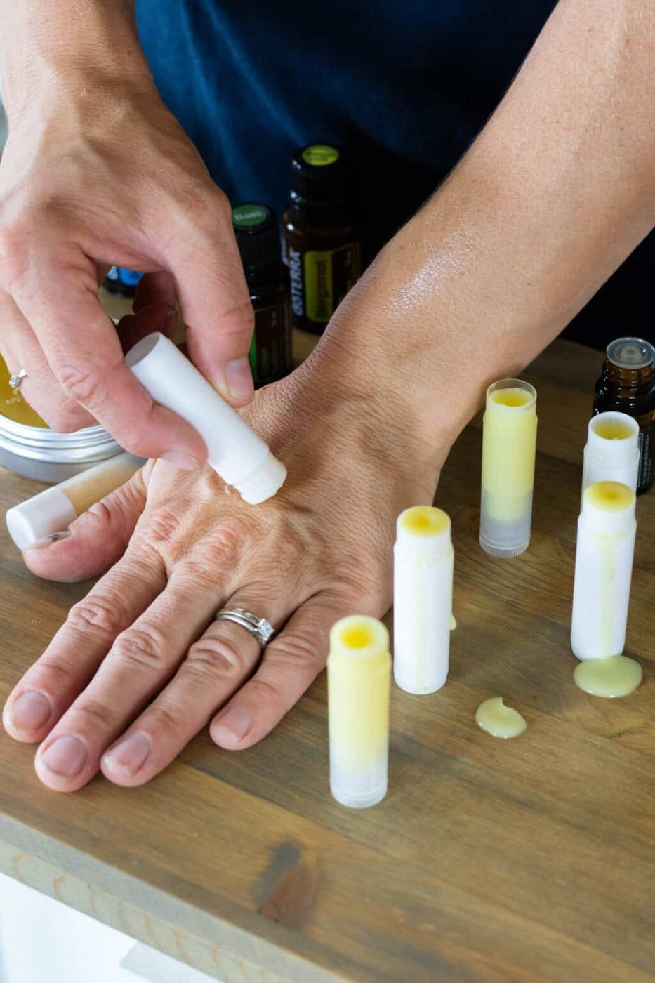 Applying the homemade anti itch cream to a bug bite on the back of our hand.