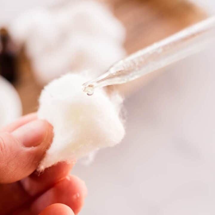 Adding drops of witch hazel and tree tea to help with an ingrown hair.
